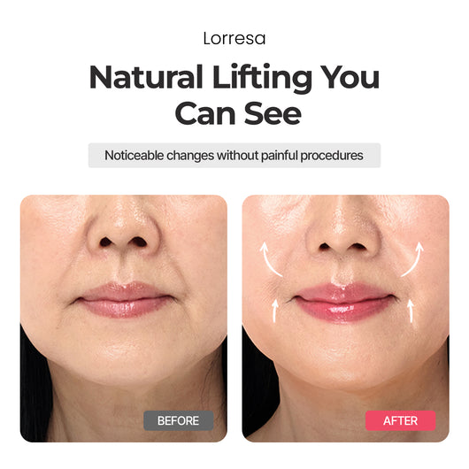 Lorresa Olléra | 6-in-1 Beauty Device